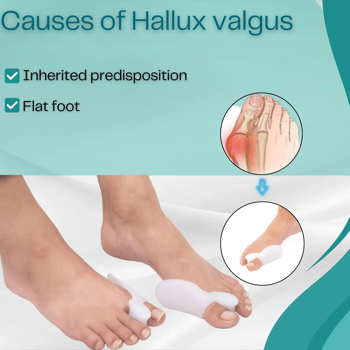 Wonder_Care_Silicone_Toe_Separator_For_Feet_Gel_Toe_Pads_Toe_Big_Toe_Corrector_Bunion_Toe_Straightener_Yoga_Toe_Stretcher_Hammer_Toe_Bunion_White_[Pair_of_2-4_Pieces]__Wonder Care__undefined