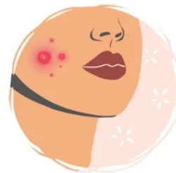 SHOP_BY_CONCERN_ACNE_PRONE_SKIN__DARZATA