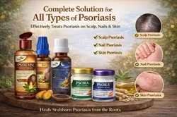 SHOP_BY_CATEGORY_PSORAISIS__Ayurveda Shri