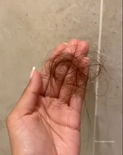 SHOP_BY_CONCERN_HAIR_FALL__BETEL BOTANICA