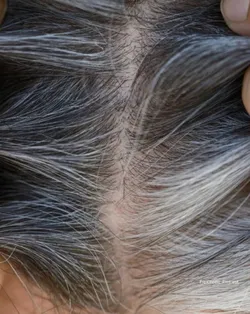 SHOP_BY_CONCERN_PREMATURE_GREYING__BETEL BOTANICA