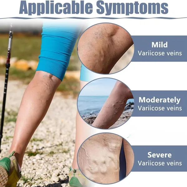 pack_of_2_Varicose_Veins_Patches_|_Herbal_Leg_Care_Patches_|_Relaxing_Cooling_Patches_for_Tired_Legs_|_Gentle_Daily_Use