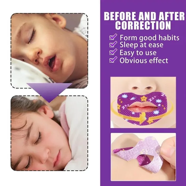 Anti-Snoring_Sticker_non-woven_fabric_Anti-Snoring_Sticker,_Adult_and_Kids_Night_Sleep_Lip_Nose_Breathing_Improving_Mouth_Correction_Sticker,_Sleep_Mouth_Tape_for_Snoring_(30pcs).