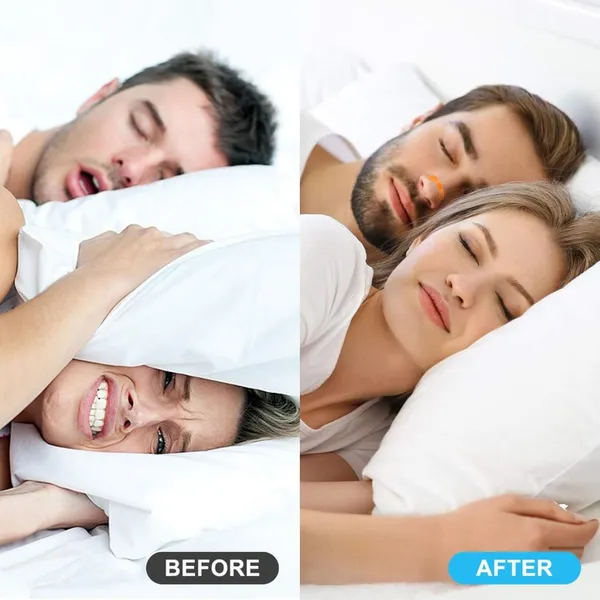 Breathing_Nasal_Strip_Starter_Kit_Boost_Oxygen_Intake,_Reduce_Snoring,_Improve_Sleep_Quality,_Sweat_Resistant,_Skin_Safe_Nasal_Strips_-_Extra_Strength_Snoring_Solution_Sugar_Control_Acupressure_(Pack_of_15_Set).