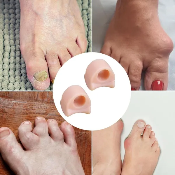Imported_1_Pair_Silicone_Valgus_Toe_Overlapping_Separator_Straightener_Bunion_Spacers_Corrector_Hallux_Valgus_Relief_Foot_Care_Tool_(Beige)
