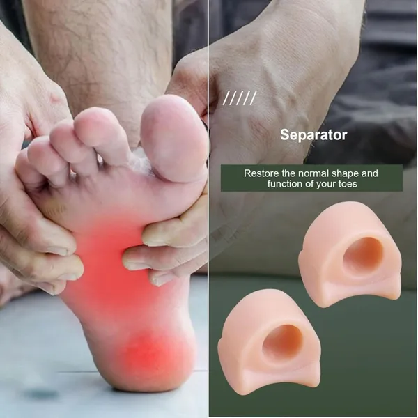 Imported_1_Pair_Silicone_Valgus_Toe_Overlapping_Separator_Straightener_Bunion_Spacers_Corrector_Hallux_Valgus_Relief_Foot_Care_Tool_(Beige)