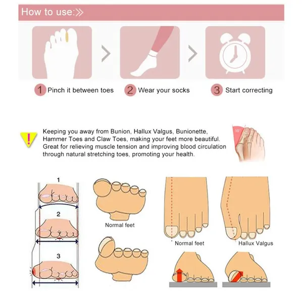 Imported_1_Pair_Silicone_Valgus_Toe_Overlapping_Separator_Straightener_Bunion_Spacers_Corrector_Hallux_Valgus_Relief_Foot_Care_Tool_(Beige)