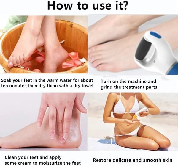 Pink_Foot_Roller_Callus_Remover_Hard_And_Dead_Skin_|Feet_Care_Callus_|Pedicure_for_Hard_Cracked_Skin,_Foot_Scrubber_Roller_|pedicure_machine_foot_spa_electric_for_home(MULTI_COLOR)