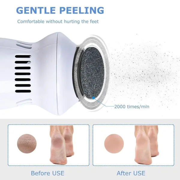 White_Rechargeable_And_Water_Resistant:_Pedi_With_Two_Speeds_Cracked_Heels_Repair_Machine