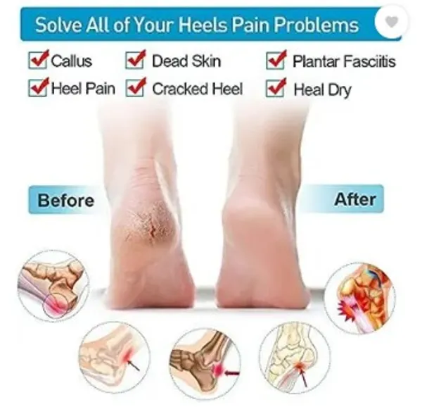 FLYTOP_Beauty_care_Moisturizing_Gel_Heel_Socks_Foot_Support_Ankle_Support_Silicone_Heel_Support