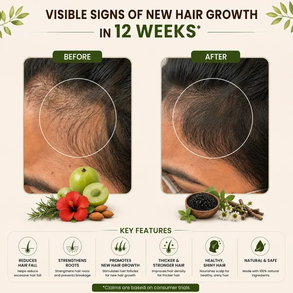 Versana_Ayurveda_Rosemary_Hair_Growth_Oil
