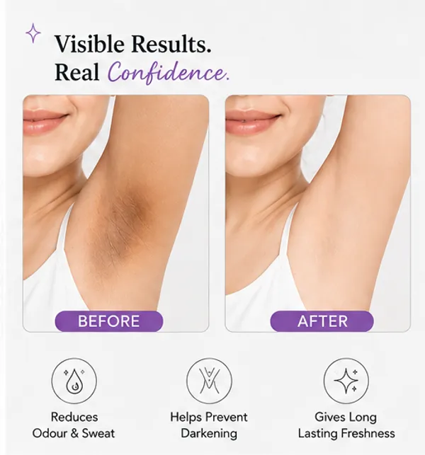 Versana_Khamglow_Underarm_Roll_On_Deodorant