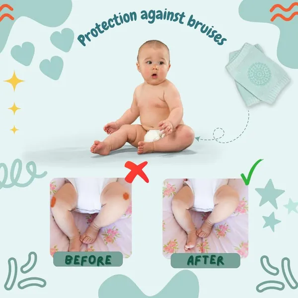 10_Piece_Multicolor_Safety_Protector_Knee_&_Elbow_Pads_For_Toddlers_And_Infants_|_Anti-Slip_Crawling_Support_|_Soft,_Stretchable_Cotton_Cushion_For_Knee_Protection