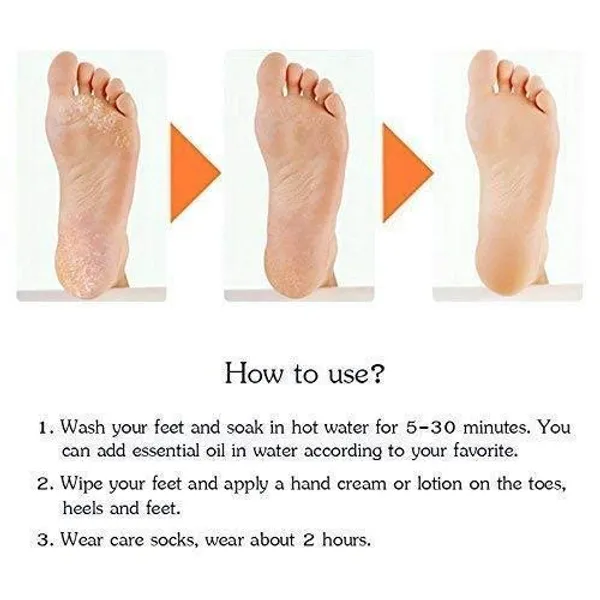 Anti_Crack_Silicone_Gel_Foot_Protector_Moisturizing_Socks_for_Foot-Care_and_Heel_Cracks_Socks_for_Cracked_Feet_Heel_Pad_For_Feet,_Silicon_Heel_Pad_For_Women_Pain_Relief,_Crack_Heel_Repair_Socks_Full_Length_Silicone_Gel_Foot_Protector1_Pair