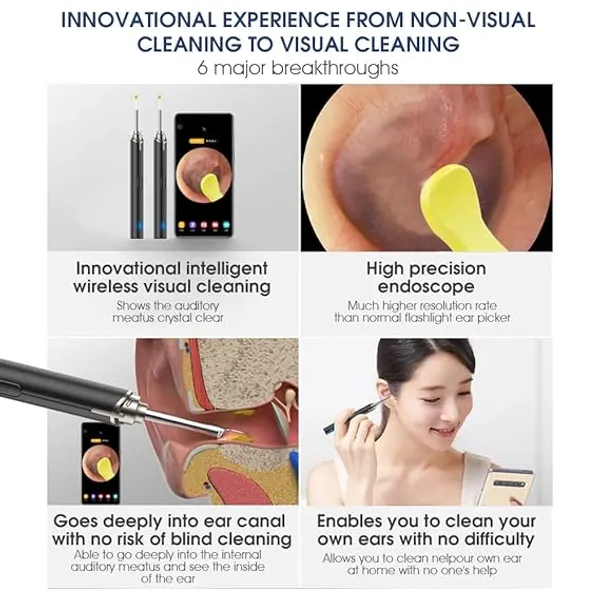 Ss_Paking_Ear_Cleaning_Kit