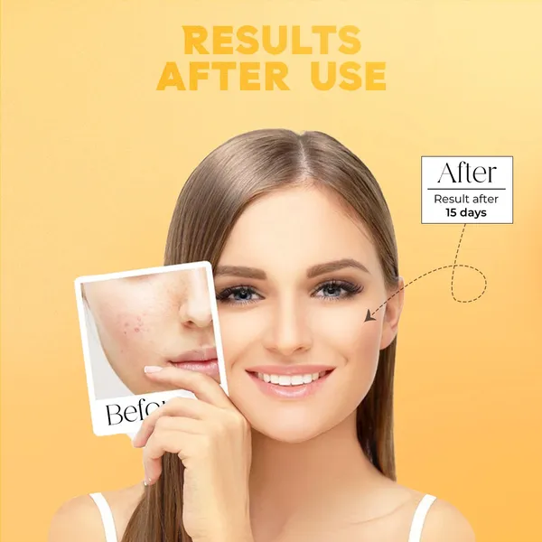 Skincare_Sinche_Body_Soap,_100_grams,_is_natural_and_nourishing._It_uses_herbal_extracts_to_gently_cleanse_and_moisturize_the_body._Fit_for_Every_Type_of_Skin_Pack_of_4