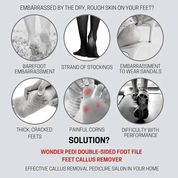 5_Piece_Hard_Skin_Remover_Pedicure_Foot_Scraper