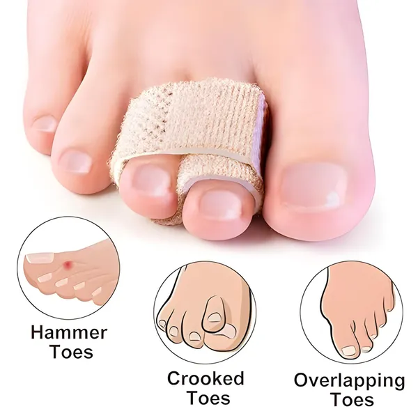 Beige_Silicone_Toe_Separator_For_Soft_Comfortable_Foot_Care_(Pack_Of_2)