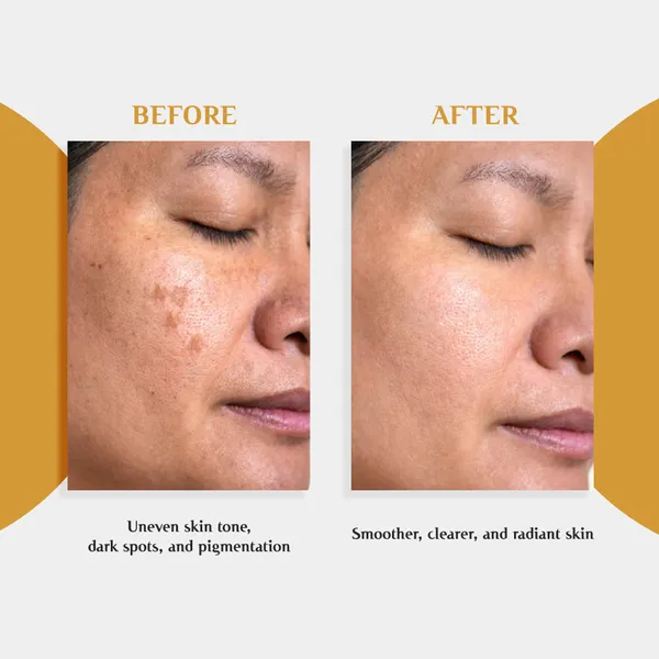Anti-Pigmentation_Cream_-_Lightning_Glow