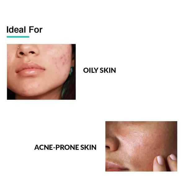 Tea_Tree_&_Papaya_Fruit_Extract_Radiance_Glow_Face_Serum_|_Non-Sticky_&_Ayurvedic_Formula_|_30_ml