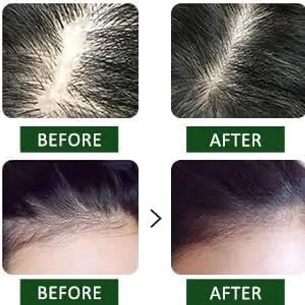 Rosemary_Water_For_Hair_Growth,_Mist_Spray_Steam_Distilled_100%_Pure_And_Natural_Hydrosol,_Hair_Mist_-_By_Drontila_100Ml