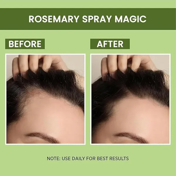 Bioleaf_Botanicals_Rosemary_Water_Spray_For_Hair_Growth_&_Hair_Thickness_With_Rice_Water_&_Henna_|100%_Natural_Extract_|_Soft_&_Smooth_Hair|_Controls_Hairfall|_Non-Greasy_&_Fast_Absorbing_|_200_Ml