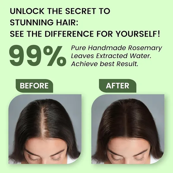 Bioleaf_Botanicals_Rosemary_Water_Spray_For_Hair_Growth_&_Hair_Thickness_With_Rice_Water_&_Henna_|100%_Natural_Extract_|_Soft_&_Smooth_Hair|_Controls_Hairfall|_Non-Greasy_&_Fast_Absorbing_|_200_Ml