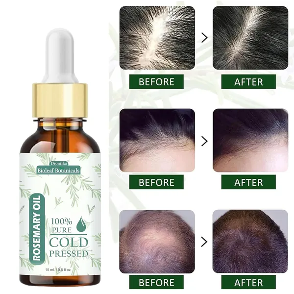 Bioleaf_Botanicals_Rosemary_Hair_Growth_Combo_Rosemary_Water_Hair_Spray_(200Ml)_&_Advanced_Hair_Growth_Serum_(30Ml)_Strengthens_Roots,_Reduces_Fall_&_Promotes_Thicker,_Fuller_Hair