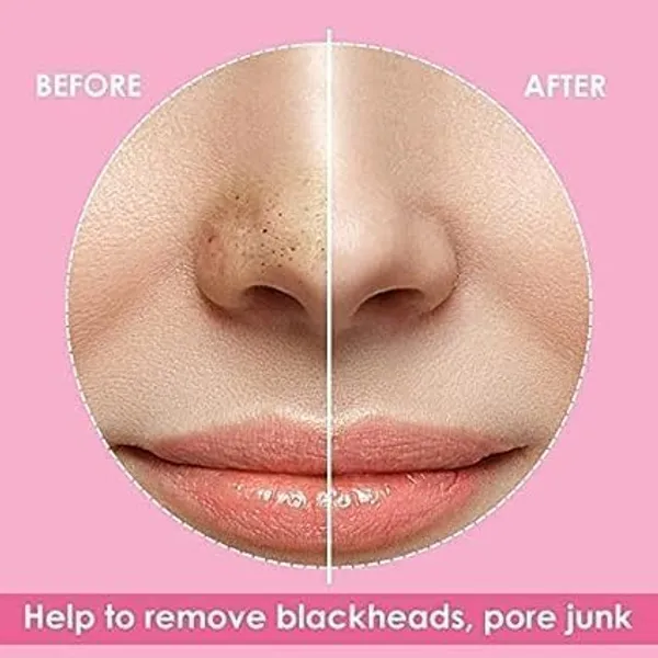 _Nose_Strips,_Blackhead_Remover_Remover_&_Pore_Cleanser_Skincare_Cleansing_Charcoal_Nose_Patch_Peel_Off_Nose_Sticker_For_Women_And_Man_(20_Strips)