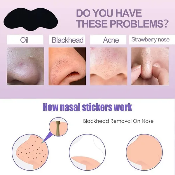 _Nose_Strips,_Blackhead_Remover_Remover_&_Pore_Cleanser_Skincare_Cleansing_Charcoal_Nose_Patch_Peel_Off_Nose_Sticker_For_Women_And_Man_(20_Strips)