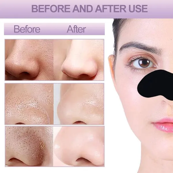 _Nose_Strips,_Blackhead_Remover_Remover_&_Pore_Cleanser_Skincare_Cleansing_Charcoal_Nose_Patch_Peel_Off_Nose_Sticker_For_Women_And_Man_(20_Strips)