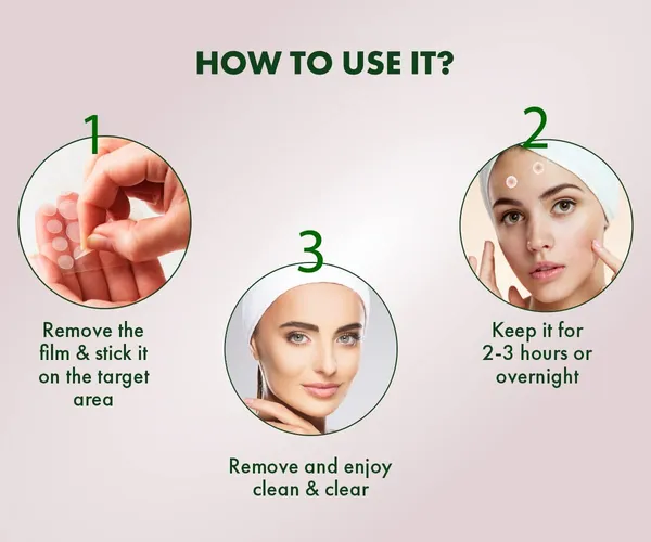 _Acne_Pimple_Patches_For_Face_-_72_Pcs_Invisible_Facial_Stickers_Cover_With_100%_Hydrocolloid_Dressing_Cover,_Effectively_Calms_&_Relieves_Acne,_Facial_Care,_Complete_Pimple_Remover