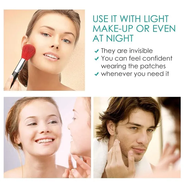_Acne_Pimple_Patches_For_Face_-_72_Pcs_Invisible_Facial_Stickers_Cover_With_100%_Hydrocolloid_Dressing_Cover,_Effectively_Calms_&_Relieves_Acne,_Facial_Care,_Complete_Pimple_Remover
