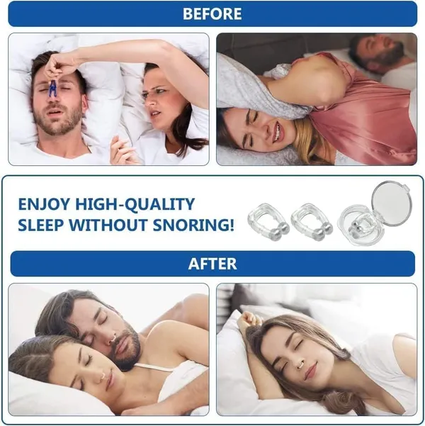 _Anti_Snoring_Nose_Clip_Device_For_Men_And_Women,_Skin_Safe_Sleep_Nasal_Strips,Instant_Releif_From_Snoring,Boost_Oxygen_Intake_Snoring_Stopper_Nose_Clip._(Pack_Of_2)