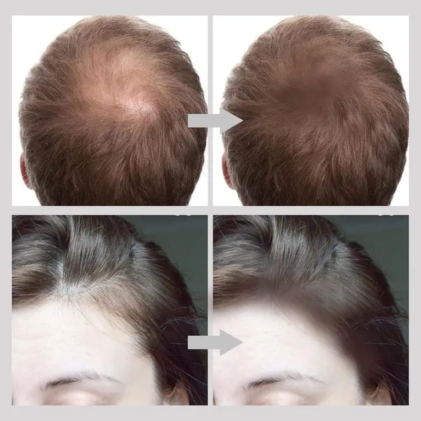 _Hairline_Powder_Stick,Hair_Shadow_Powder_Root_Touch_Up_Powder,_Waterproof_Hair_Shading_Sponge_Pen_Hair_Filler_Powder_For_Cover_Gray_Hair_Root,_Hair_Touch-Up,_Thin_Hair_(Brown,_4_Gram)