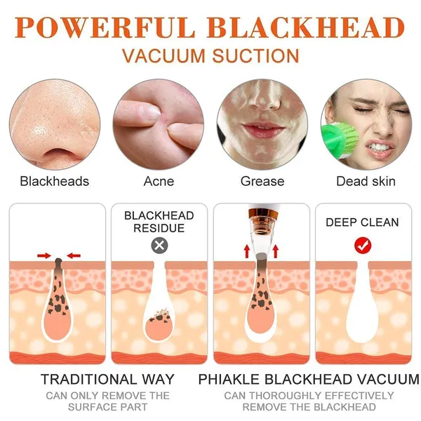 6_In_1_Derma_Section_Blackhead_Whitehead_Extractor_Blackhead_Remover_Acne_Pimple_Pore_Cleaner_Vacuum_Tools_-_Facial_Cleaner_Device_For_Nose_&_Skin_Care_Men_&_Woman_Pink