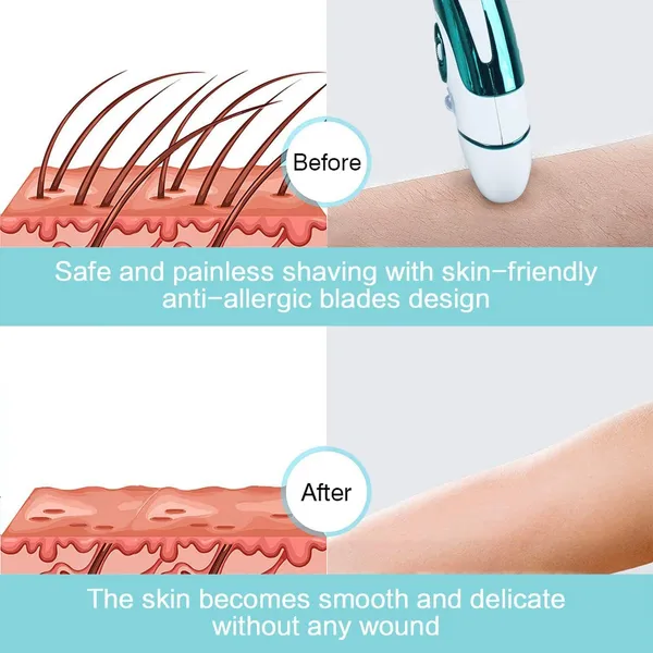 FESTIVE_BLESSINGS_DALING_Epilator_for_Women_Trimmer_90_min_Runtime_1_Length_Settings_(Multicolor)