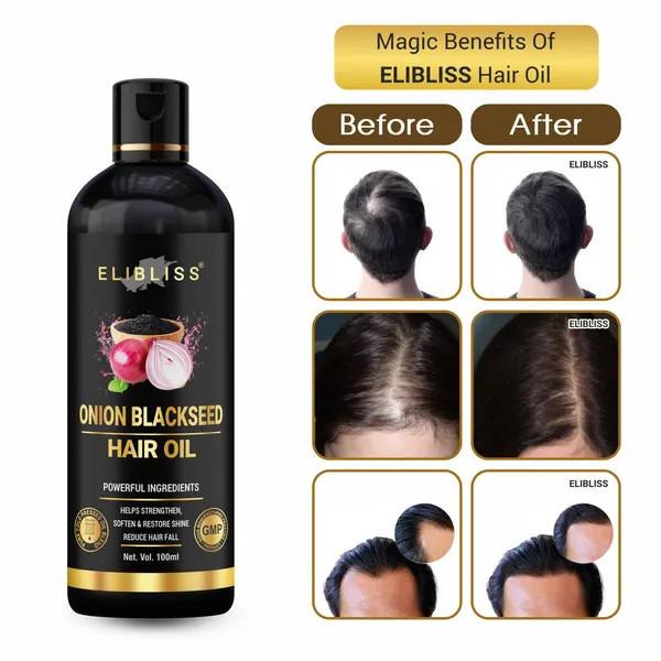 Onion_Hair_Oil_For_Hair_Fall_Control_With_Black_Seed_Oil_Extracts_-_100_Ml