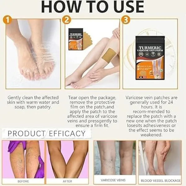 JnS_Turmeric_Varicose_Vein_Patch__Herbal_Relief_Patches_for_Legs_Swelling_Spider_Veins_and_Fatigue_Support_varicose_veins_(pack_of_2)