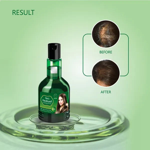 Pack_Of_2_Ikvans_Ayurvedic_Medicine_Ikva_Keshwell_Oil_|_Use_For_Damage_Hair,_For_Hair_Fall