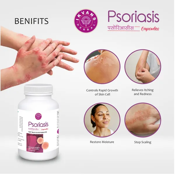 Ikvans_Ayurvedic_Medicine_|_Use_For_Psoriasis