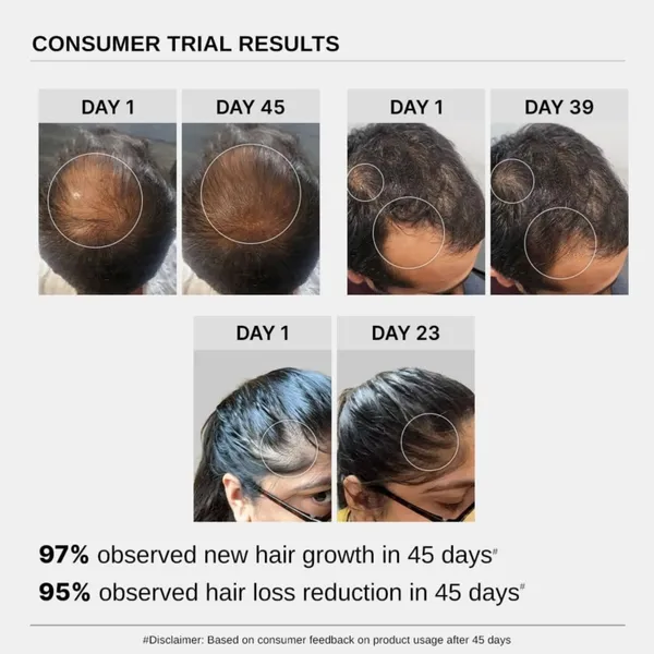 Advanced_Hair_Growth_Serum_For_Hair_Fall_Control_|_Redensyl_3%_+_Anagain_4%