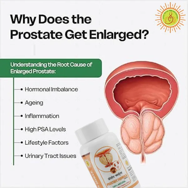 Prostate_Formula_with_Smart_Curcumin