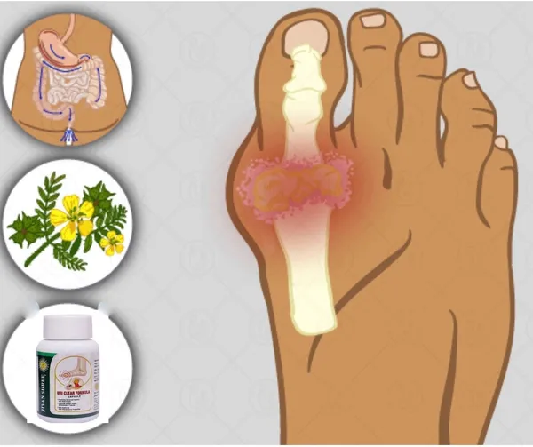 Uri_Clear_Formula_–_Ayurvedic_Medicine_for_Uric_Acid_Balance_and_Joint_Wellness