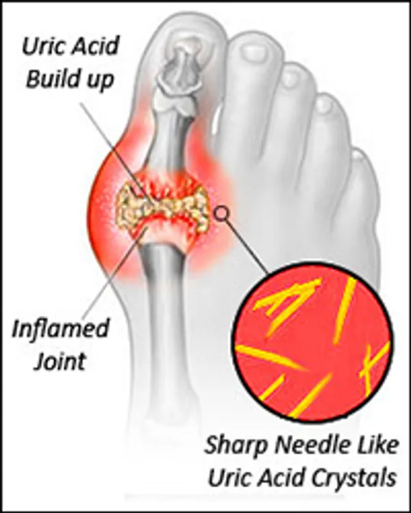 Uri_Clear_Formula_–_Ayurvedic_Medicine_for_Uric_Acid_Balance_and_Joint_Wellness