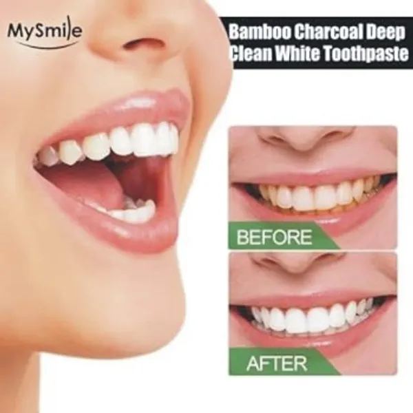 Mysmile_Bamboo_Charcoal_Toothpaste_(Pack_Of_2)_(100_Gm_Each)