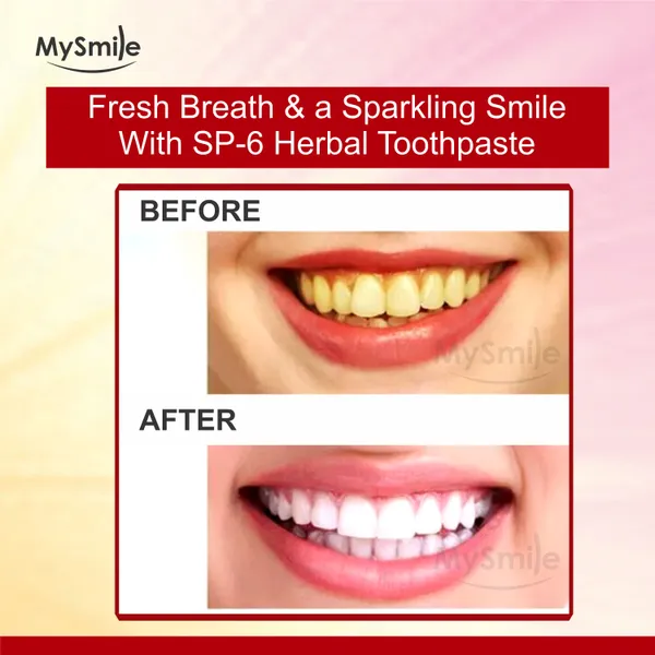 Mysmile_Sp6_Toothpaste_(100_Gm)