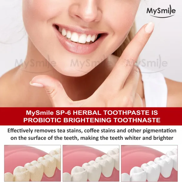Mysmile_Sp6_Toothpaste_(100_Gm)