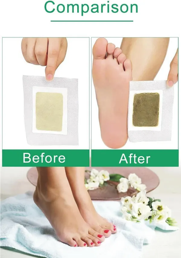 Mysmile_Foot_Patches_10_Patch,_Cleansing_Toxin_Remover_Foot_Pads,_Pain_Relief,Stress_Relief_Sleep_Patch_For_Detoxification,_For_Men_&_Women