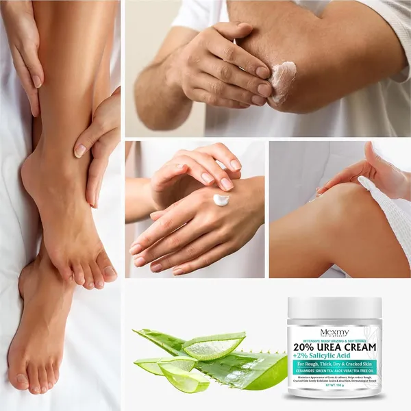 Mexmy_20%_Urea_Foot_Cream_Roll_On_100gm_|_For_Dry_&_Cracked_Heels_|_With_2%_Salicylic_Acid,_Olive_Oil_&_Vitamin_E_|_Helps_Repair_and_Moisturise_Cracked_Heels_(Pack_Of_1-100gm)